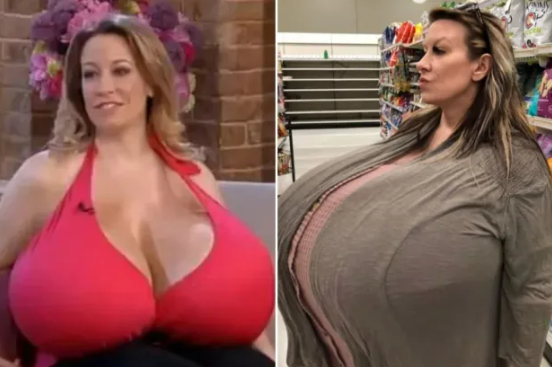 X-RATED I’ve got world’s biggest breasts with 164XXX cups – they each weigh 40lbs and could keep GROWING, says Chelsea Charms